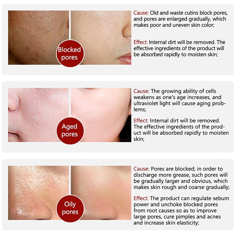 Allbelly KOREAN FACE SERUM - 30ml